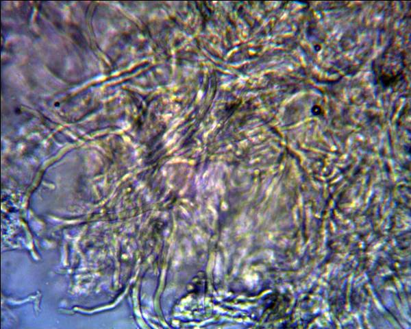 Oligoporus?? (Skeletocutis amorpha)